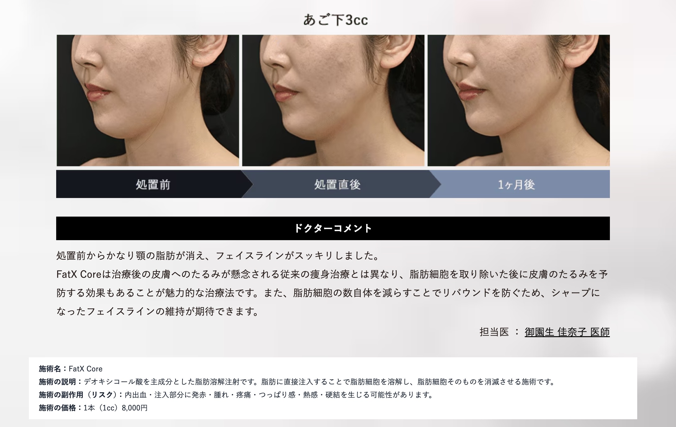 FatX Coreの症例写真