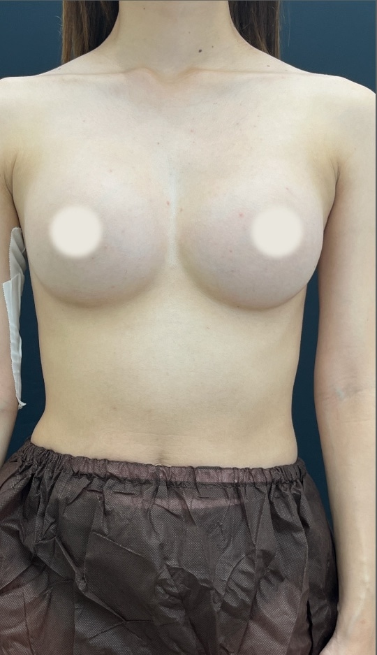 {施術名} {年代}  {性別} の術後の症例写真