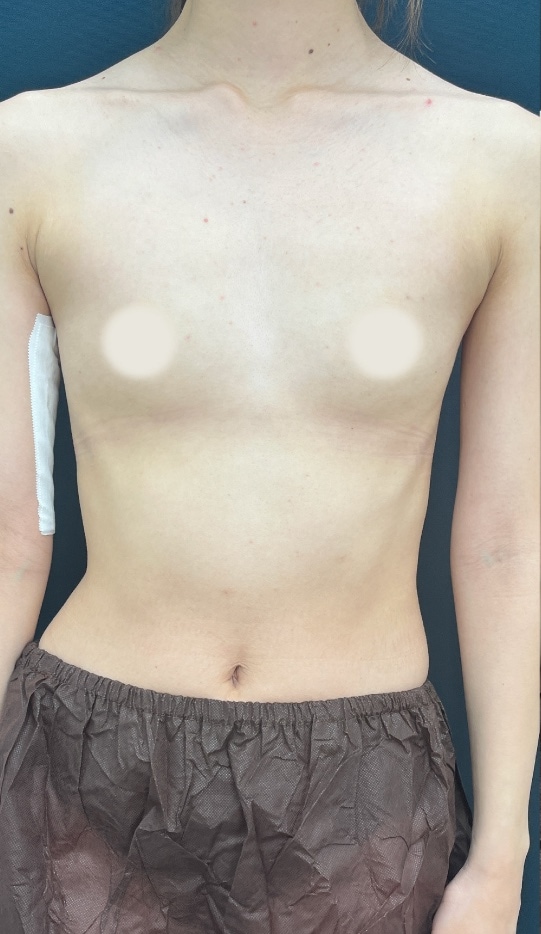 {施術名} {年代}  {性別} の術前の症例写真