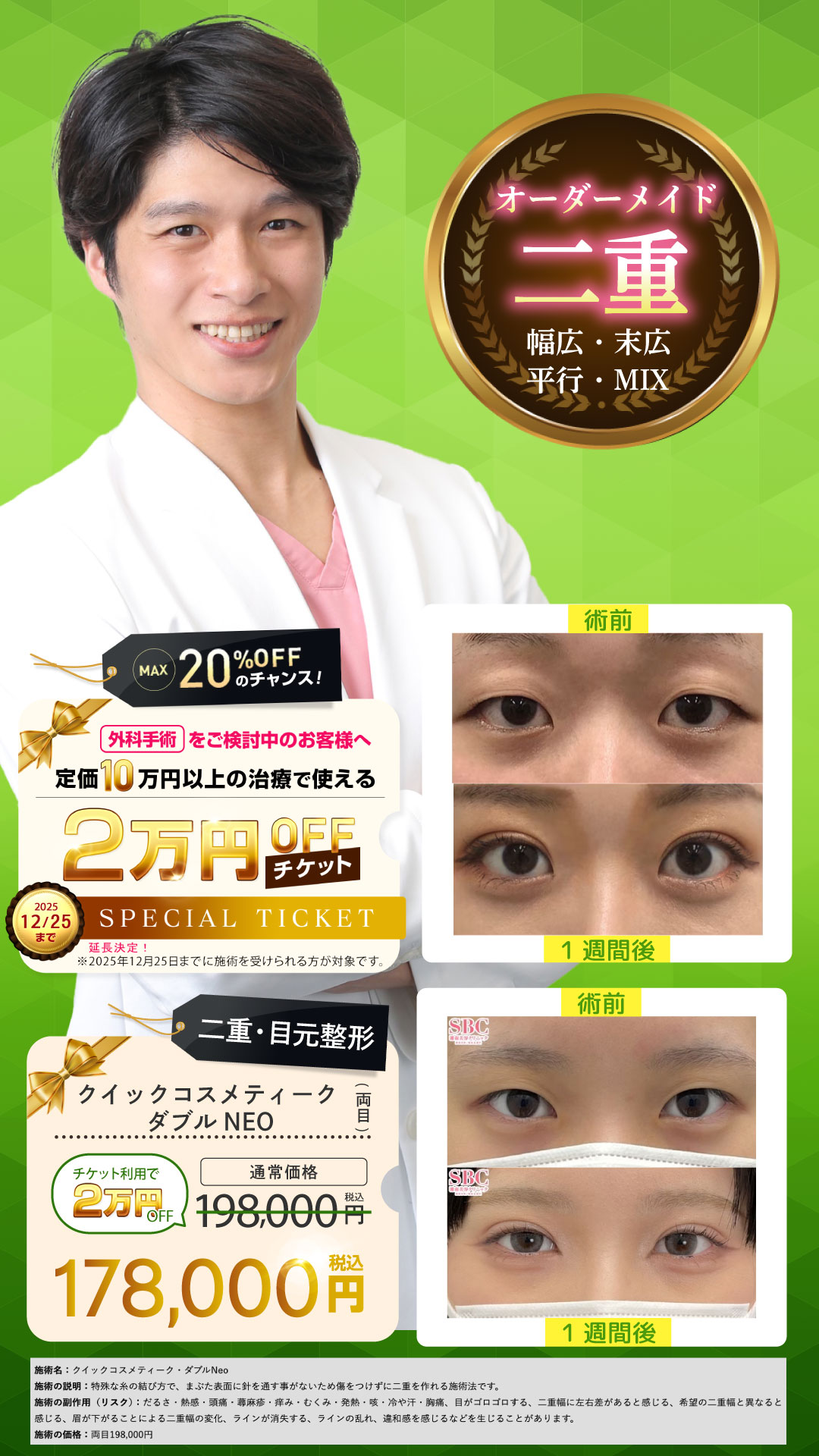 二重は比較的ダウンタイムは短め☆