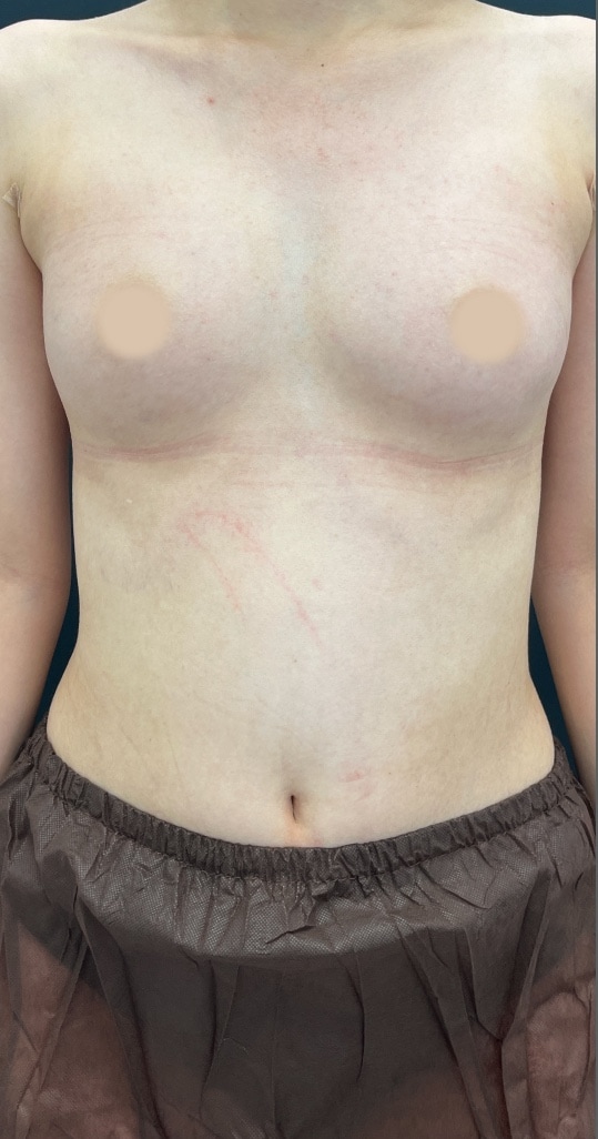 {施術名} {年代}  {性別} の術後の症例写真