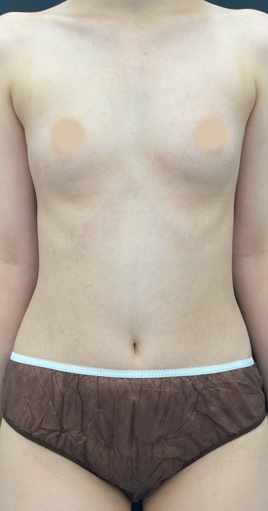 {施術名} {年代}  {性別} の術前の症例写真