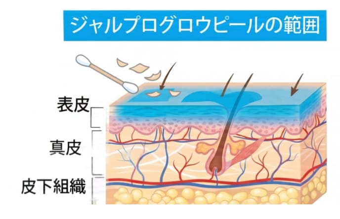 表面と深層を同時に磨く「肌育治療」<br />
