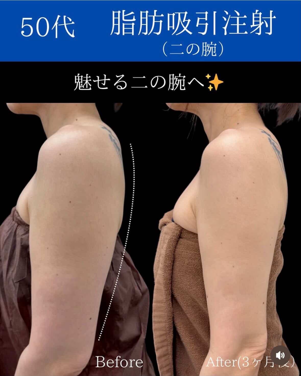 キャンペーン画像2