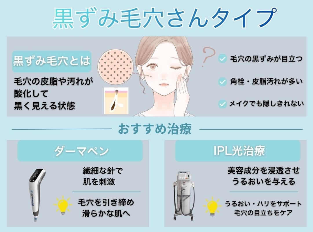 黒ずみ毛穴・メラニン毛穴に有効なアプローチは？