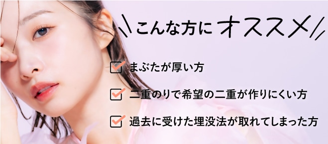 線留めクロス二重術のおすすめポイント