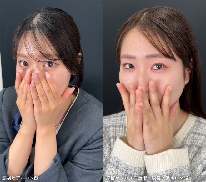 10代20代からの圧倒的な指名率100%