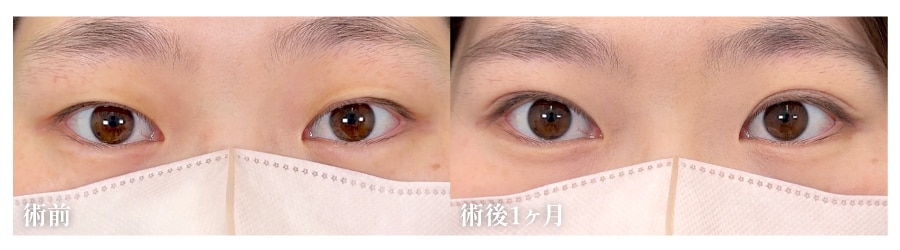ナチュラル二重、違和感ゼロ。24時間ずっとかわいい!