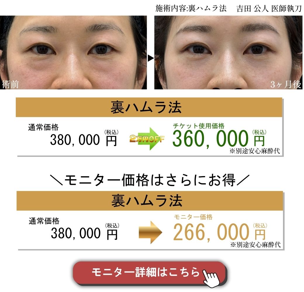 裏ハムラ症例