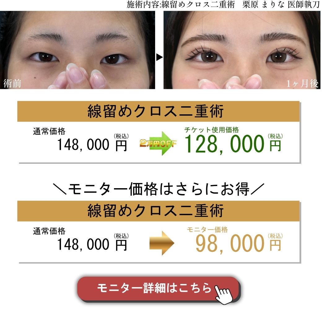線留めクロス二重術症例