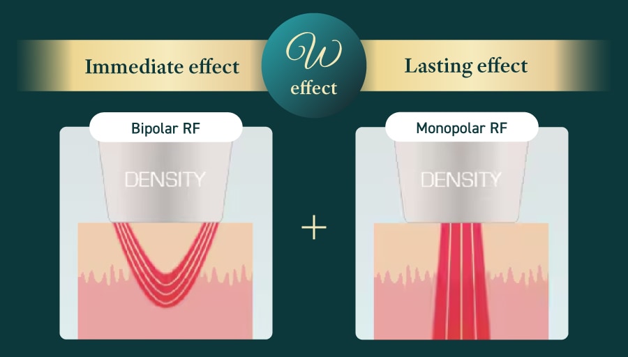 DENSITY Feature ① (Mono-Bi Technology: Monopolar + Bipolar)