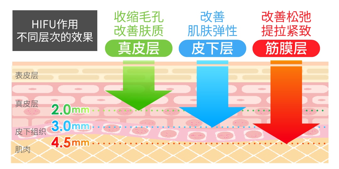 到底HIFU有什么效果？
