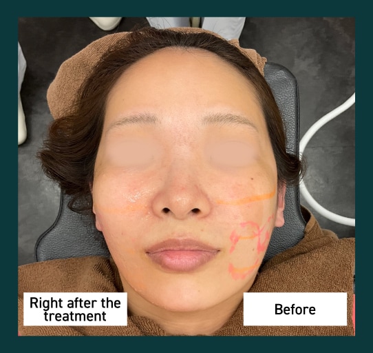 Immediate results can be felt even after just one session