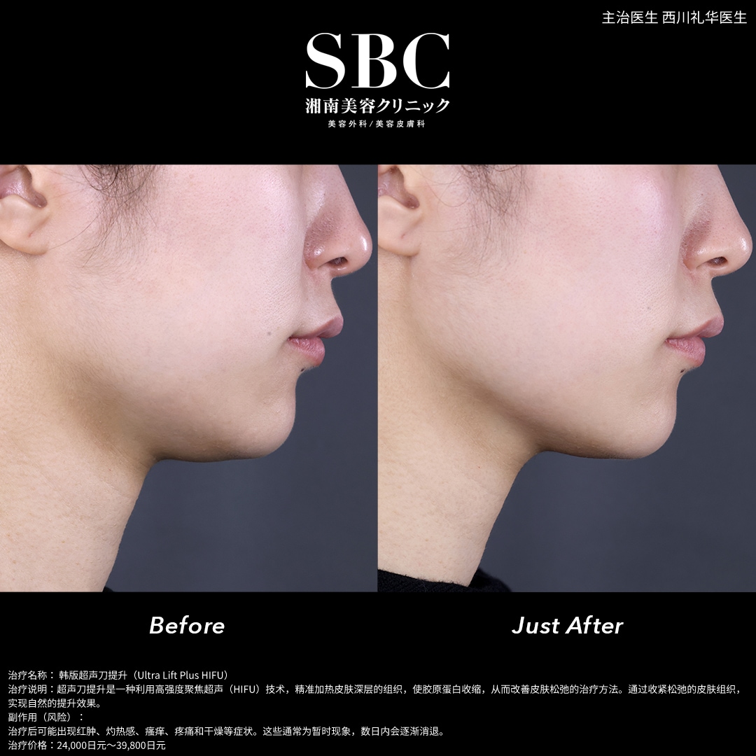 20岁后半段～30岁