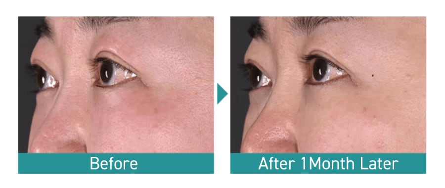 Improve fine lines and sagging around the eyes with DENSITY Eye.