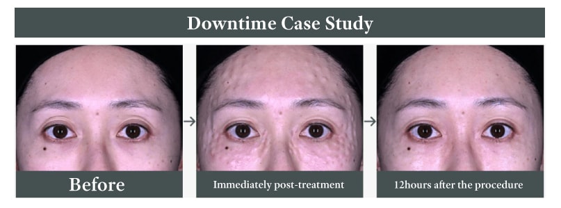 Is this a treatment failure?