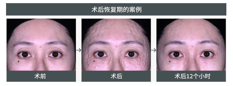 这是失败了吗？