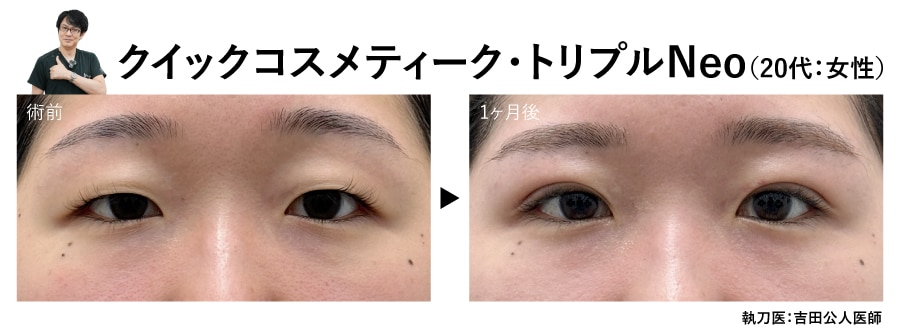 吉田医師の二重症例