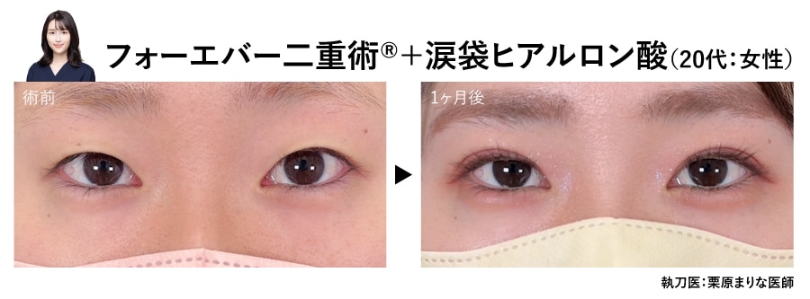 栗原医師の二重症例