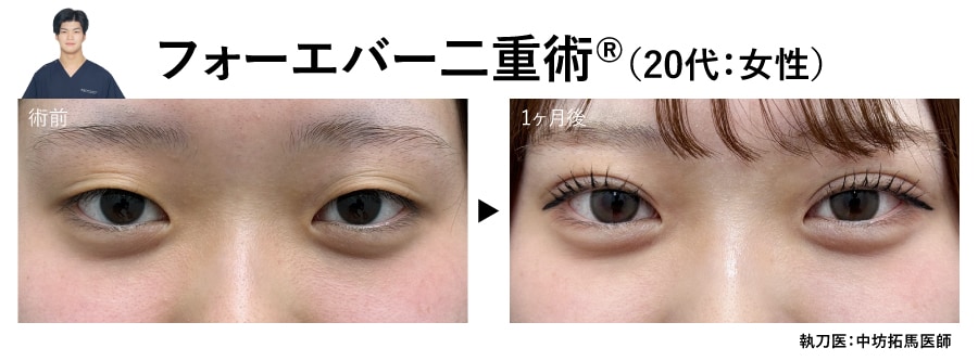 中坊医師の二重症例