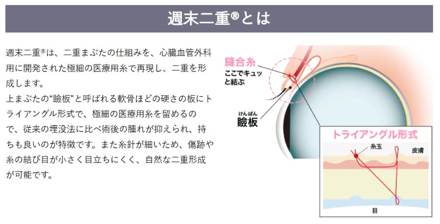 ③ お休みを利用しやすい「週末二重術」