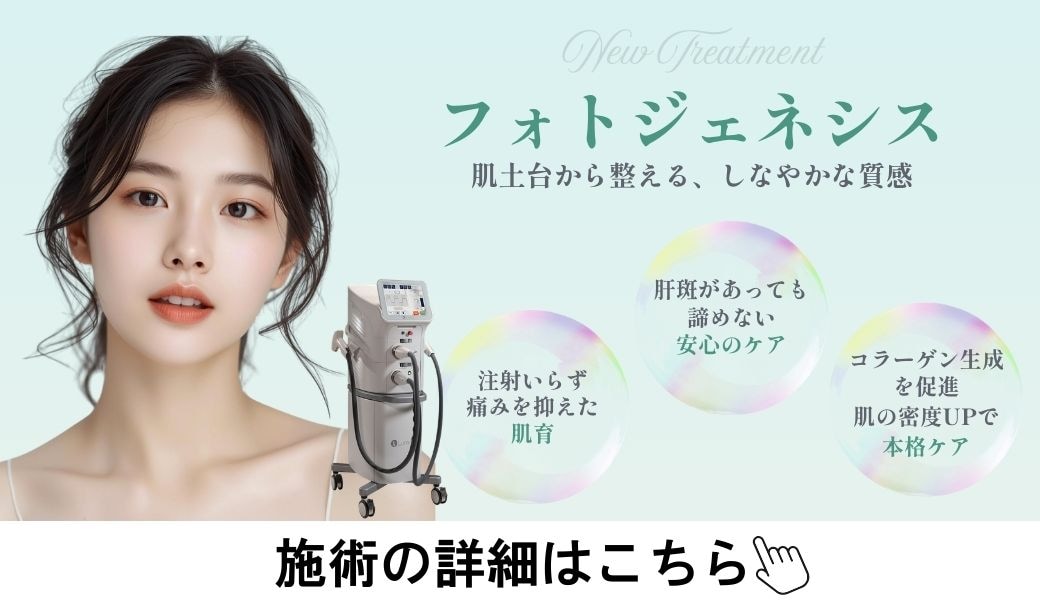 フォトジェネシス