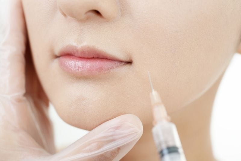 ナチュラルな若返り