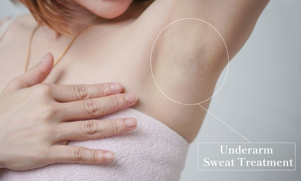 Sweat Reduction Treatment