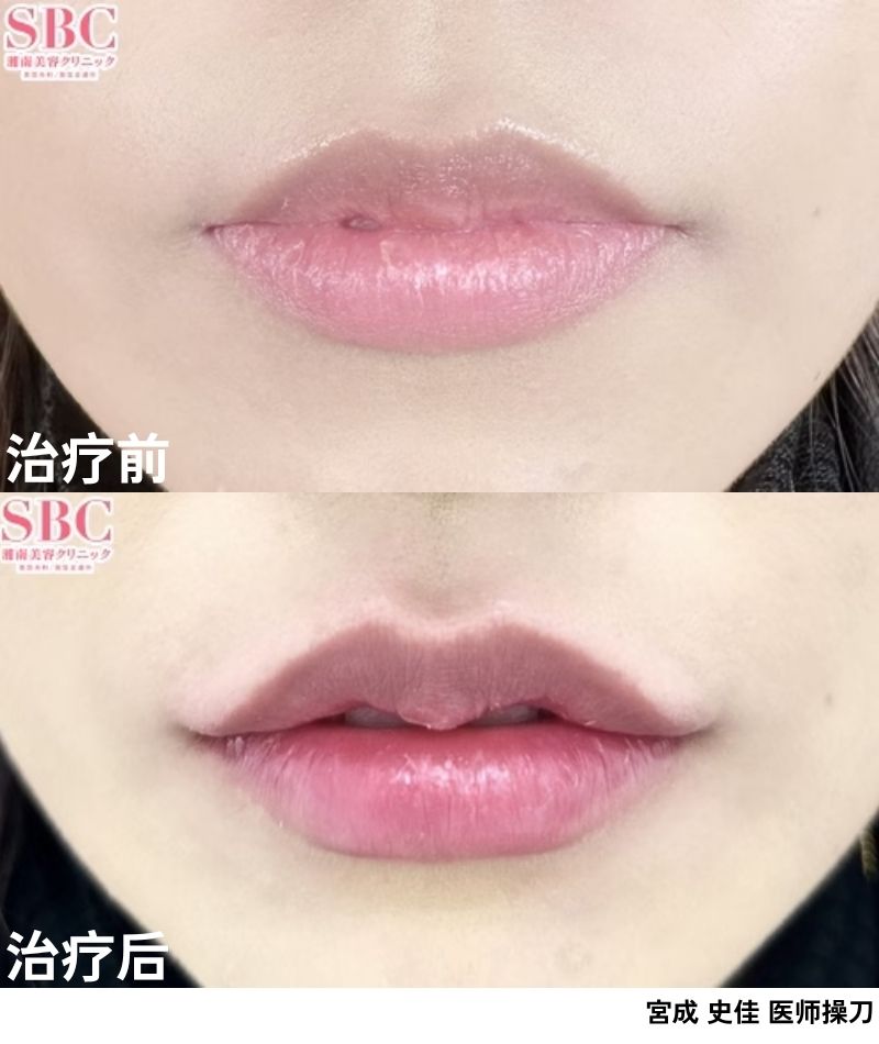 嘴唇<br />
⇨即刻打造迷人M字唇！