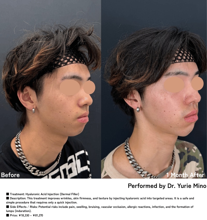 Chin