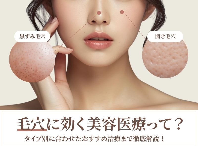 大阪で毛穴の黒ずみ・開きを改善するなら湘南美容クリニック大阪なんば院へ ｜おすすめ美容医療＆セルフケア