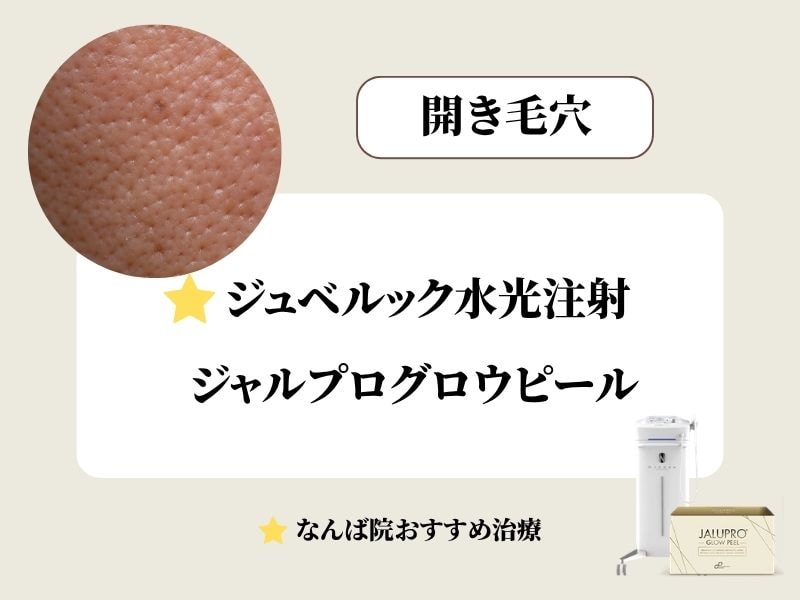 開き毛穴治療