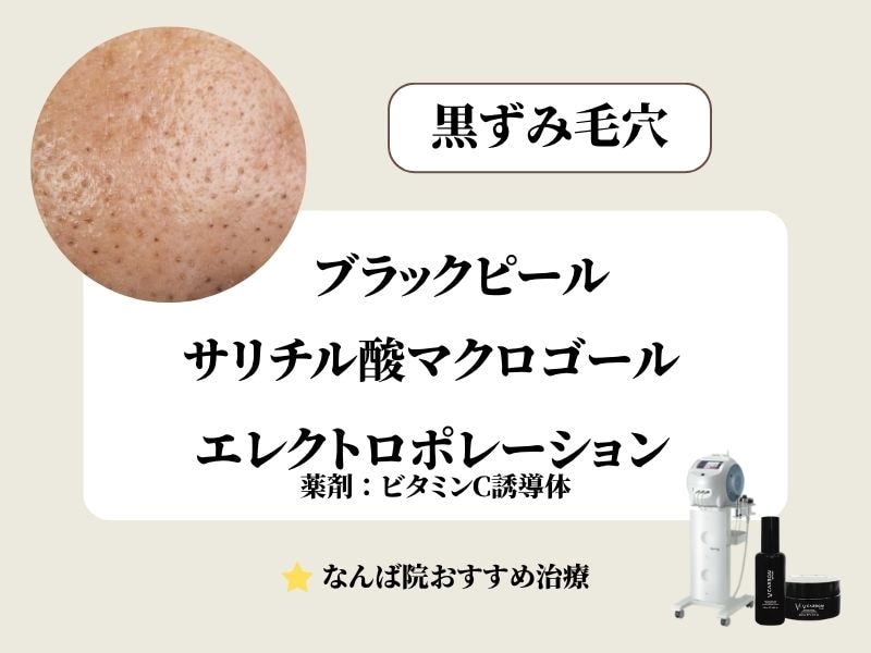 黒ずみ毛穴治療