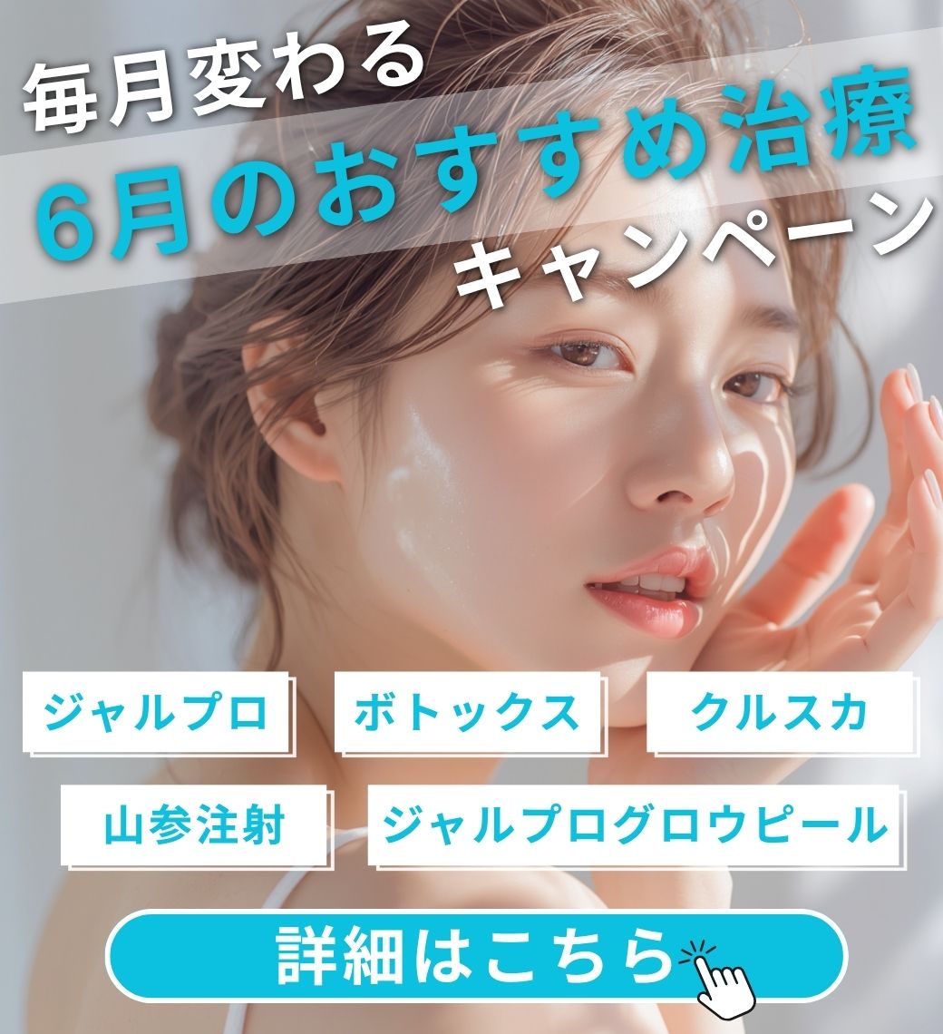 月替わりキャンペーン