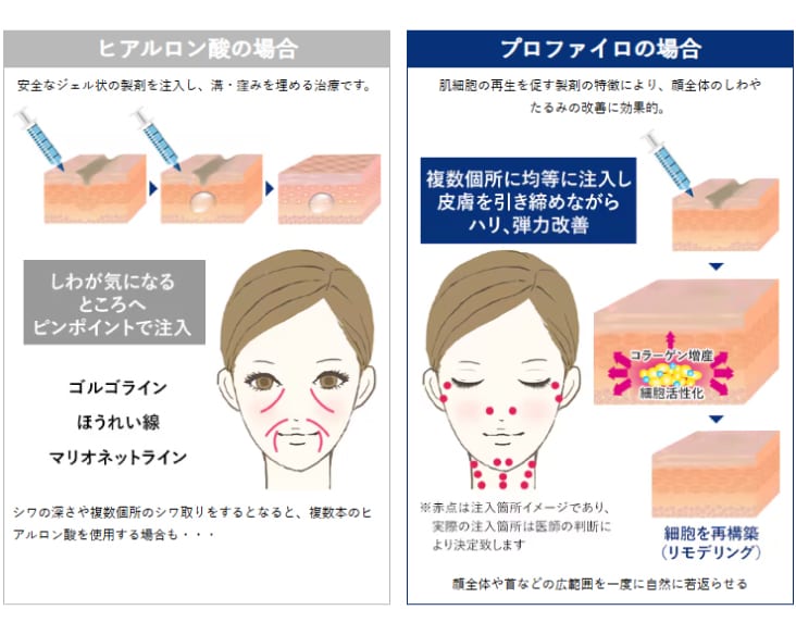 次世代肌育ヒアルロン酸