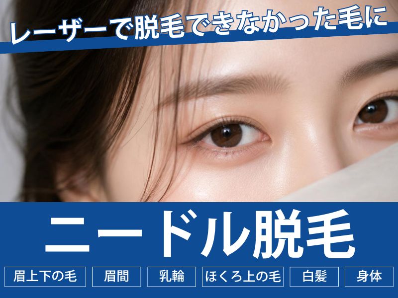 湘南美容クリニック大阪なんば院にニードル脱毛が新導入！レーザー脱毛との違いや効果を徹底解説！