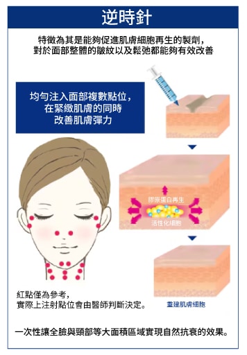 璞菲洛逆時針