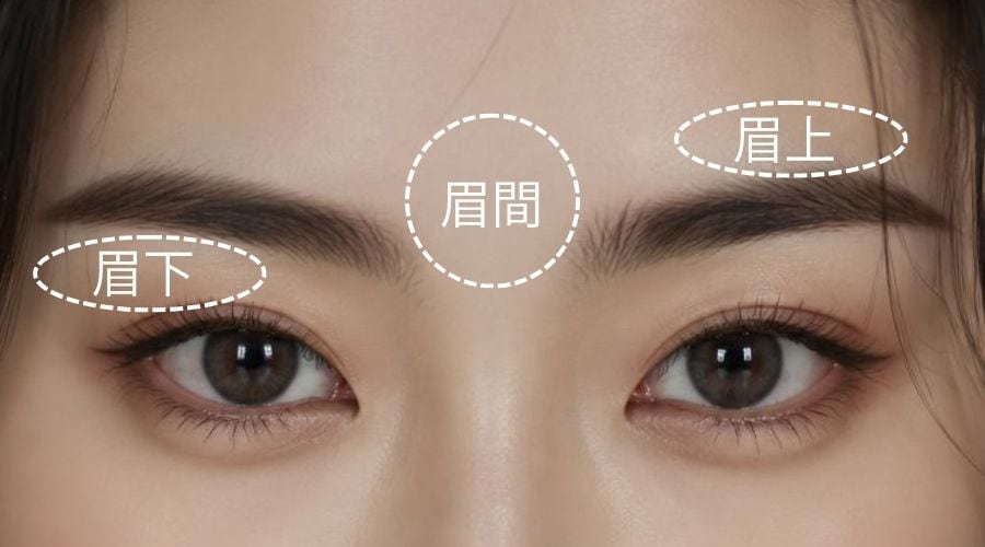 レーザー脱毛でできなかった眉周辺も対応