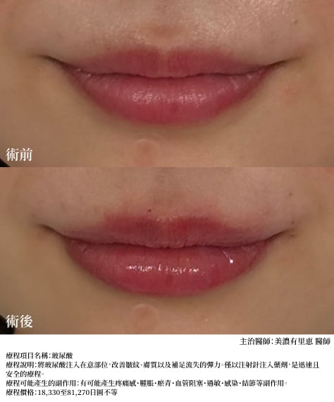 嘴唇
