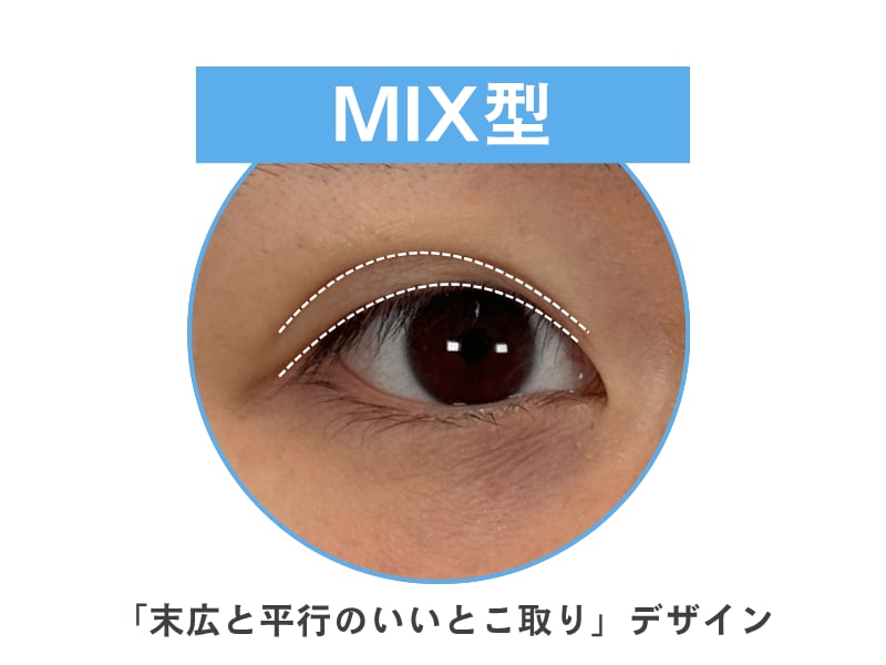 トレンドの目元にはMIX型