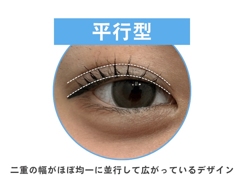 パッチリとした華やかな目元には平行型