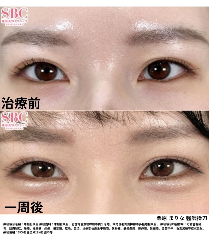 臥蠶<br />
⇨眼周水潤光亮，盡顯精緻輪廓！