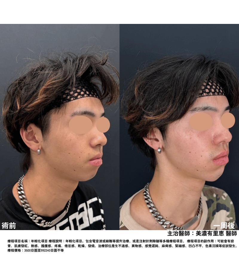 下巴