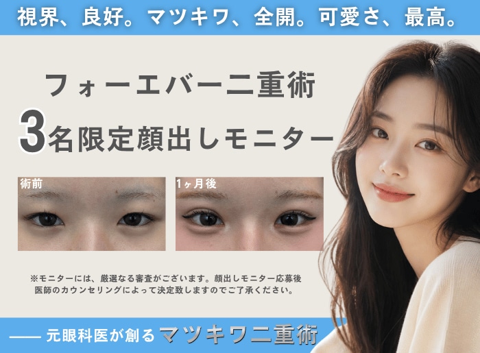 中坊医師の二重埋没法をお得に受けるチャンス！
