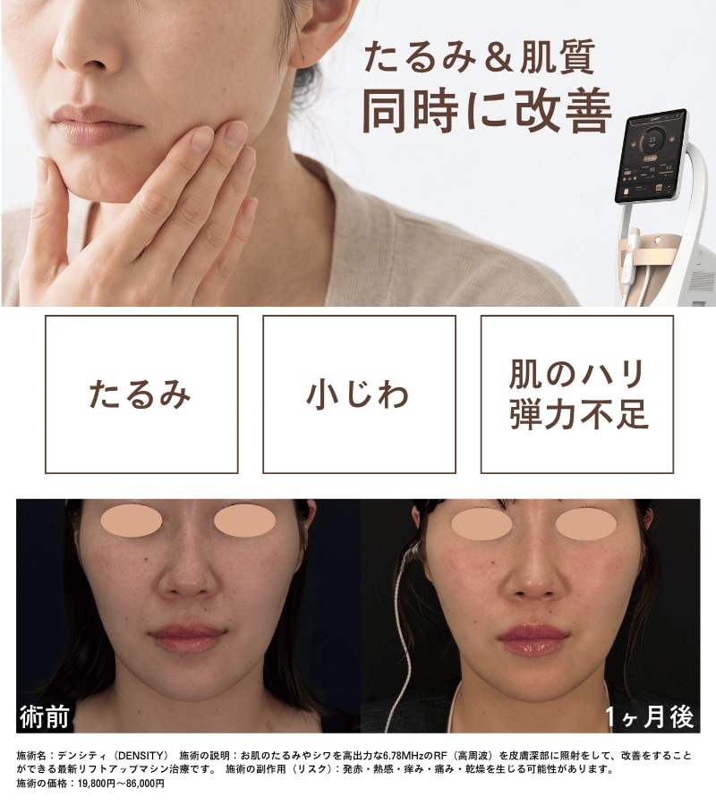 デンシティ