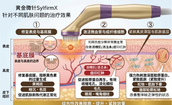 可以改善肝斑及酒糟肌等，难以治疗的「複杂肌肤问题」<br />
