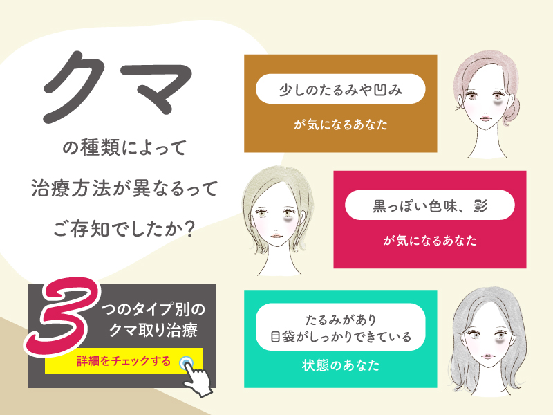 【クマのタイプ別】おすすめクマ取り治療のご紹介