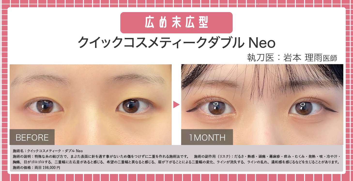 広め末広型