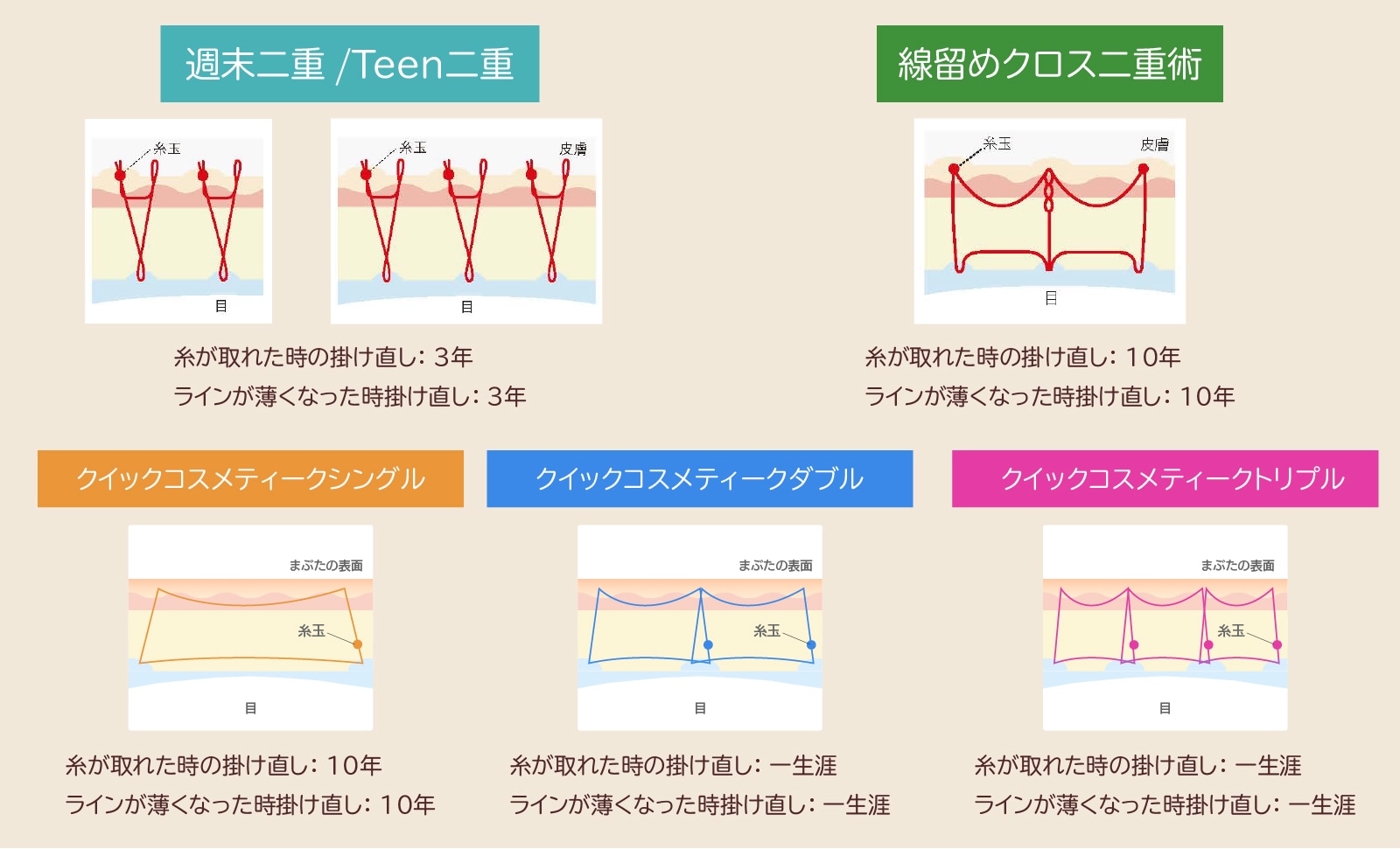 施術方法によって保証も変わる!!