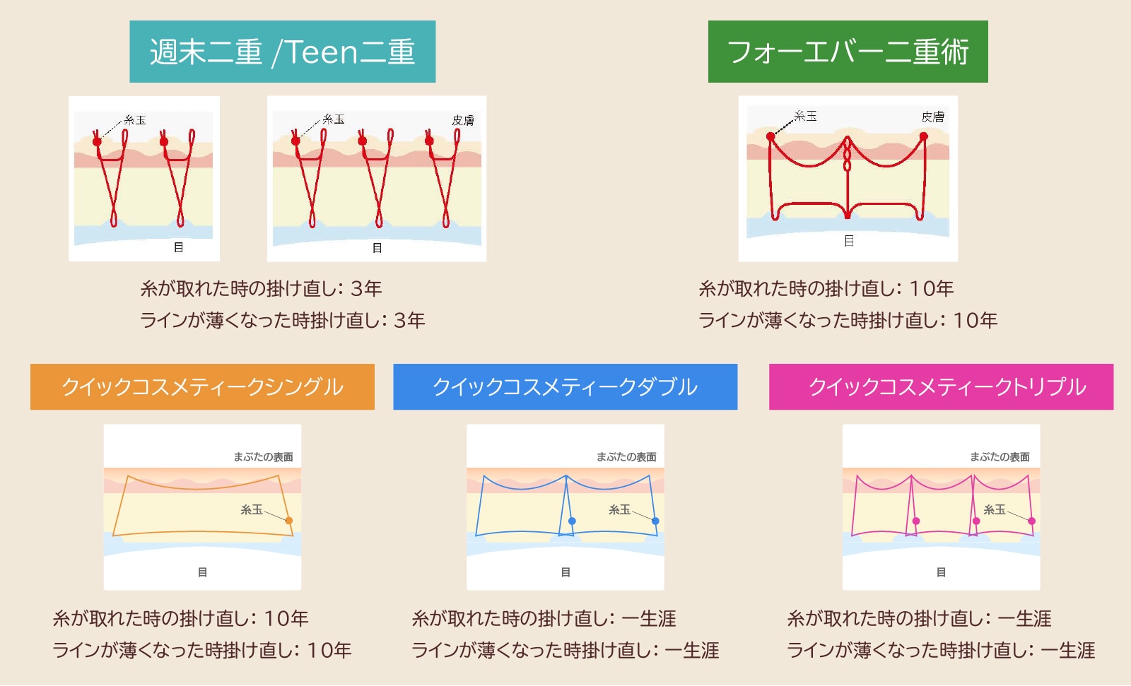 施術方法によって保証も変わる！！